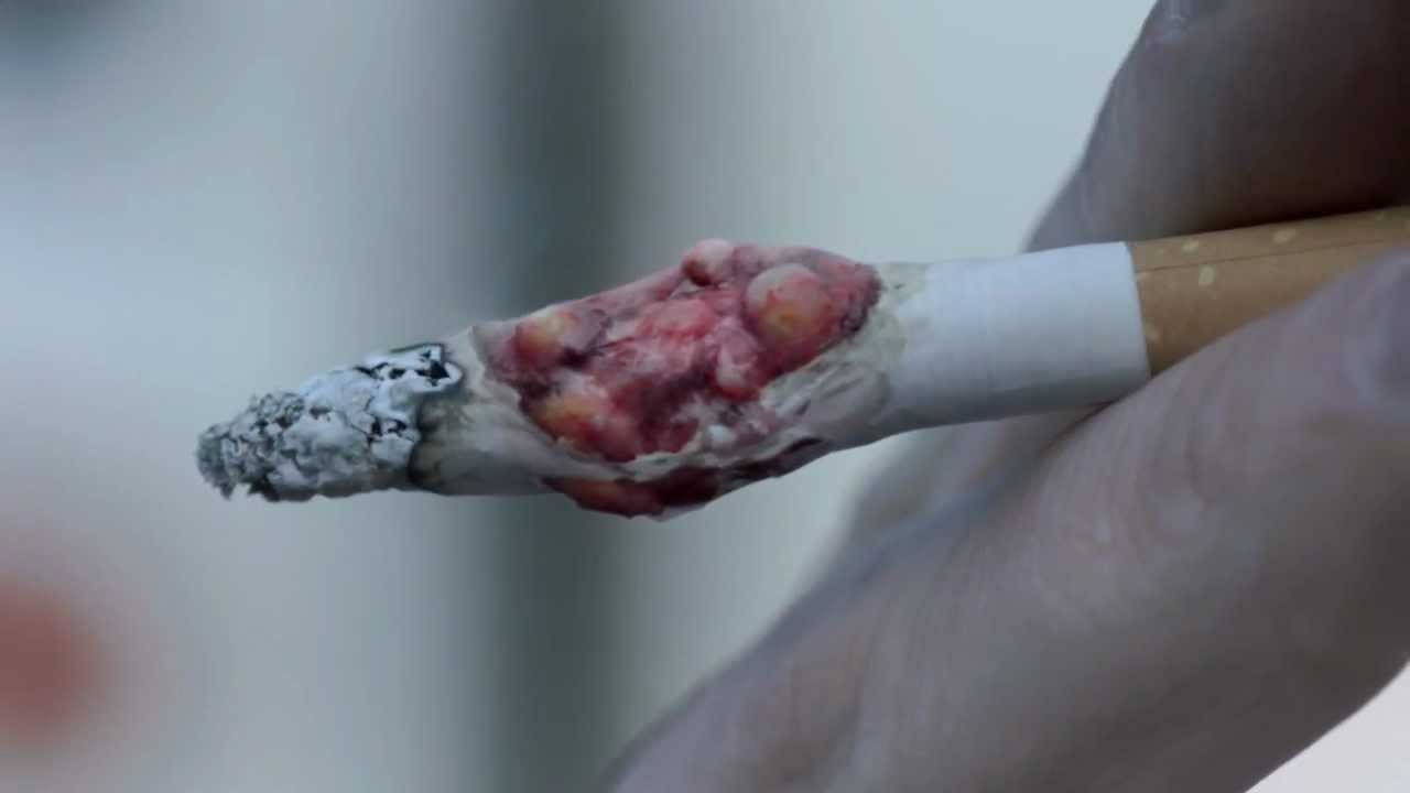 cancer and cigarettes